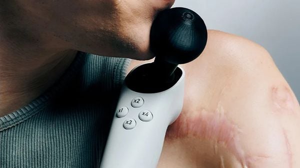 iPhone en meer: naar deze gadgets kijken we in 2025 het meest uit