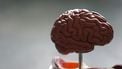 Neuralink gaat het hersenimplantaat dat het maakte testen in combinatie met een robotarm.